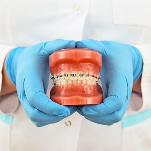 orthodontist with mouth model